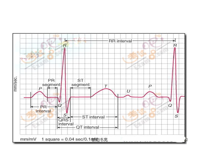 常见病心电图表现[特制荟萃].ppt_第2页