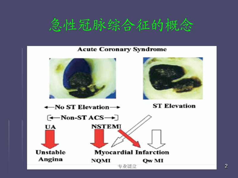 急性冠脉综合征合心律失常[特制荟萃].ppt_第2页