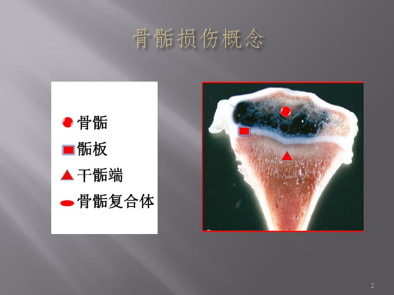 骨骺损伤分型PPT课件.pptx_第2页