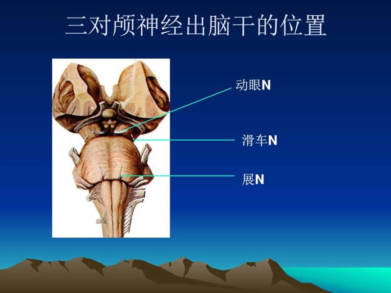 痛性眼肌麻痹_临床医学课件.ppt_第3页