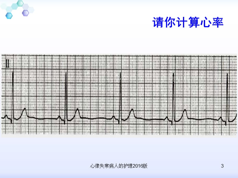 心律失常病人的护理2016版课件.ppt_第3页