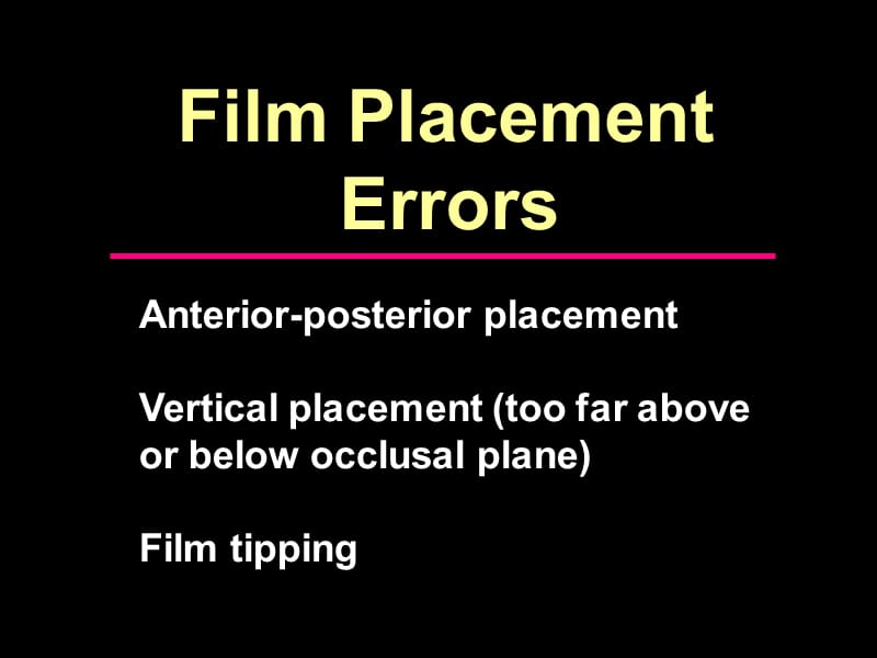 intra-oral tech-errors学会看拍牙课件.ppt_第2页