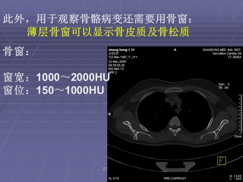 正常胸肺部CT影像学表现课件.ppt_第3页