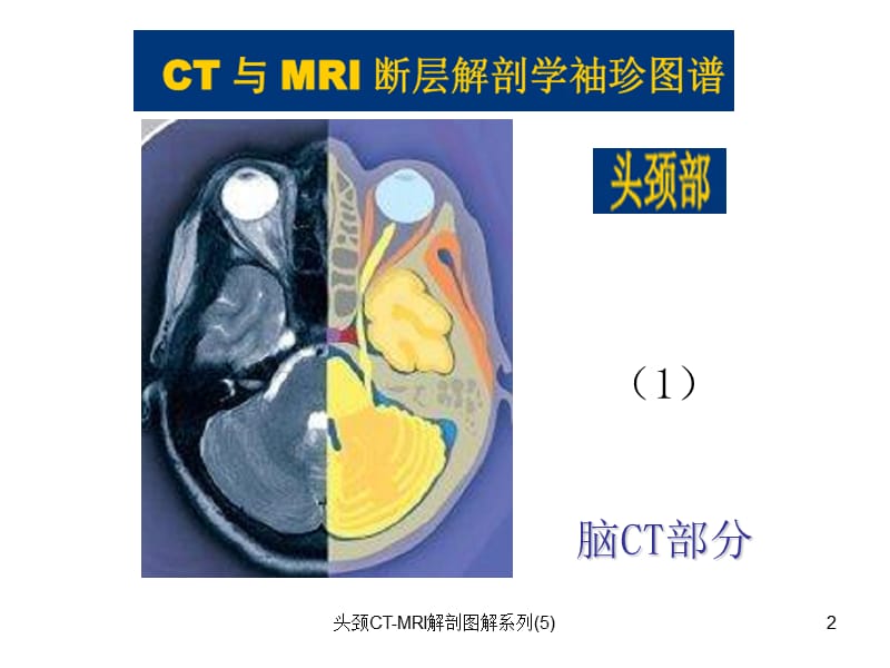 头颈CT-MRI解剖图解系列(5)课件.ppt_第2页