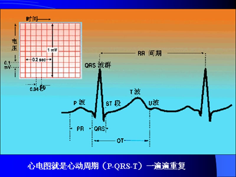 内科临床教学jx07.轻轻松松学看心电图4-心电图测试课件.ppt_第2页