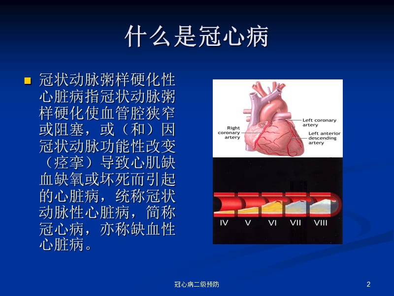 冠心病二级预防课件.ppt_第2页