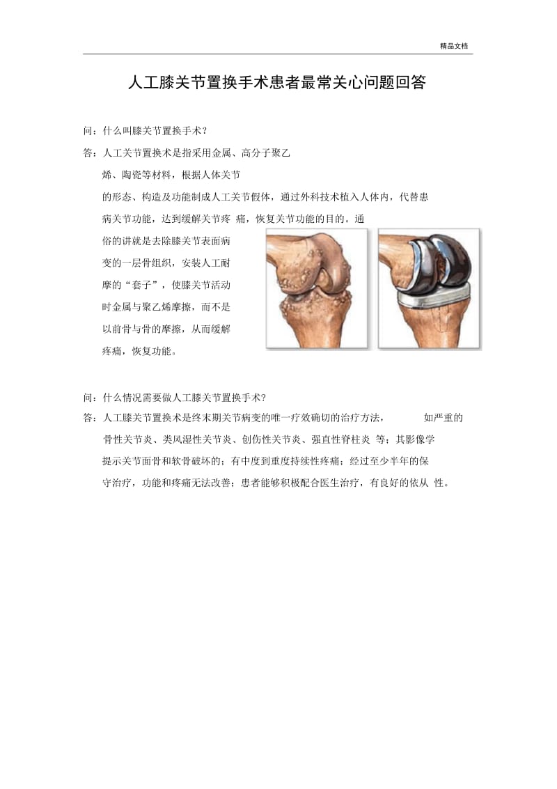 人工膝关节置换术宣教手册.docx_第1页