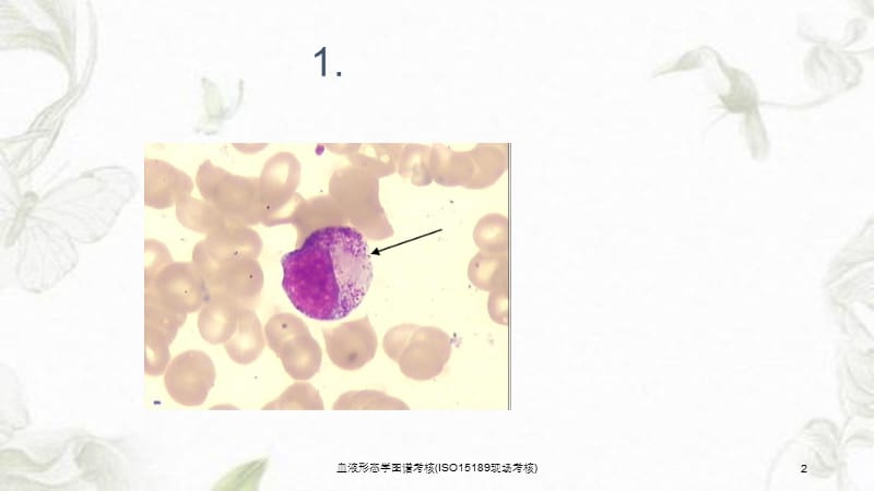 血液形态学图谱考核(ISO15189现场考核)课件.ppt_第2页