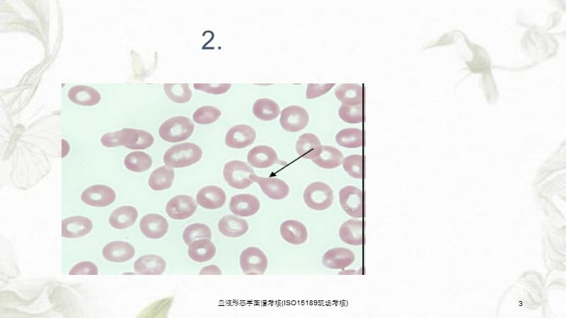 血液形态学图谱考核(ISO15189现场考核)课件.ppt_第3页