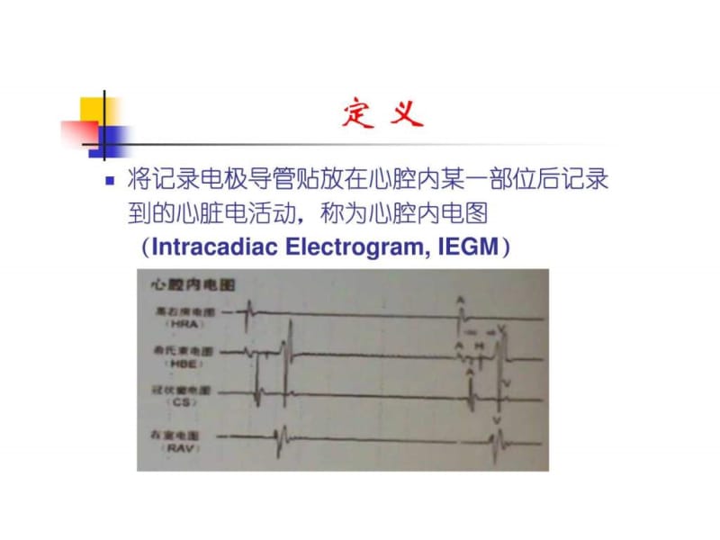 《腔内心电图》PPT课件.ppt_第2页