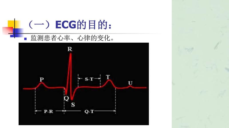 《心电监测技术》课件.ppt_第3页