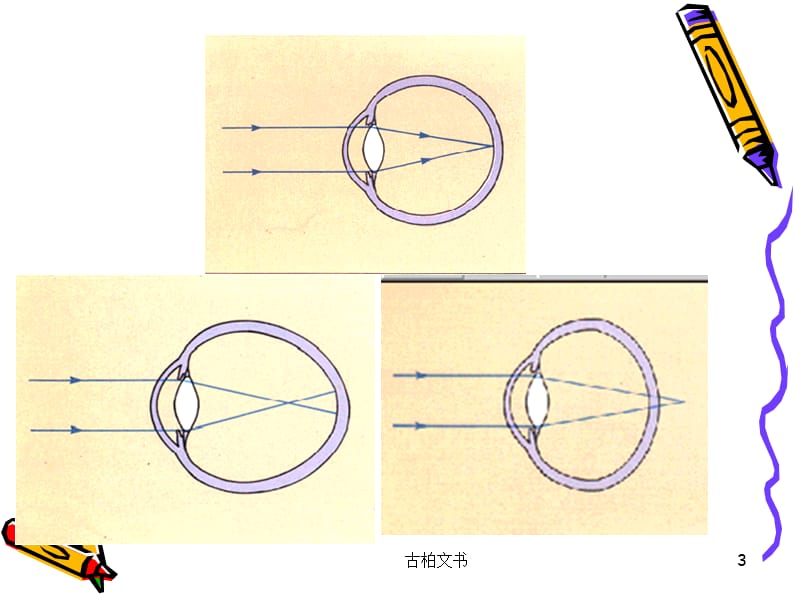 近视的预防课件【高级教育】.ppt_第3页