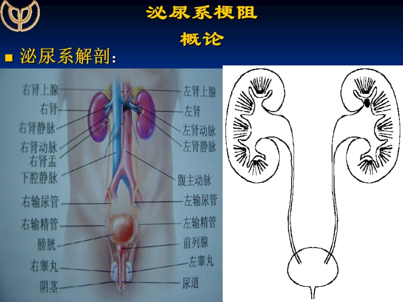 第五十一章节泌尿系梗阻 ppt课件.ppt_第3页