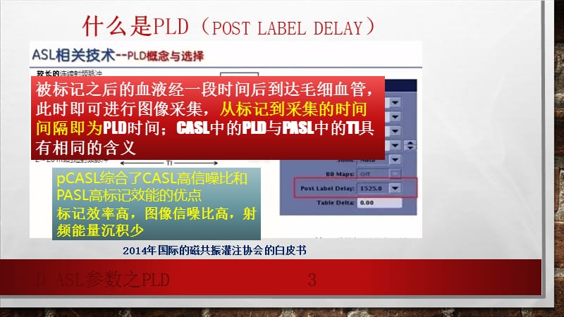 D ASL参数之PLD课件.ppt_第3页