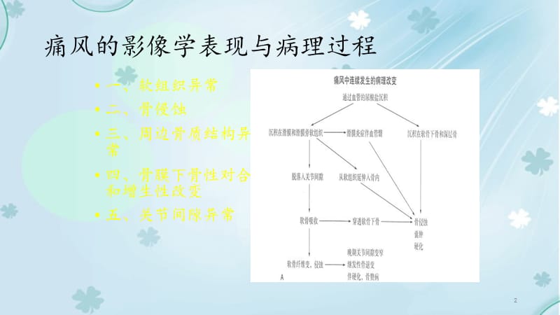 痛风的影像学表现及进展何永胜.ppt_第2页