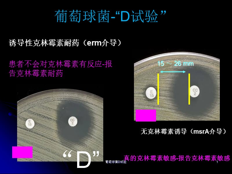 葡萄球菌D试验课件.ppt_第1页