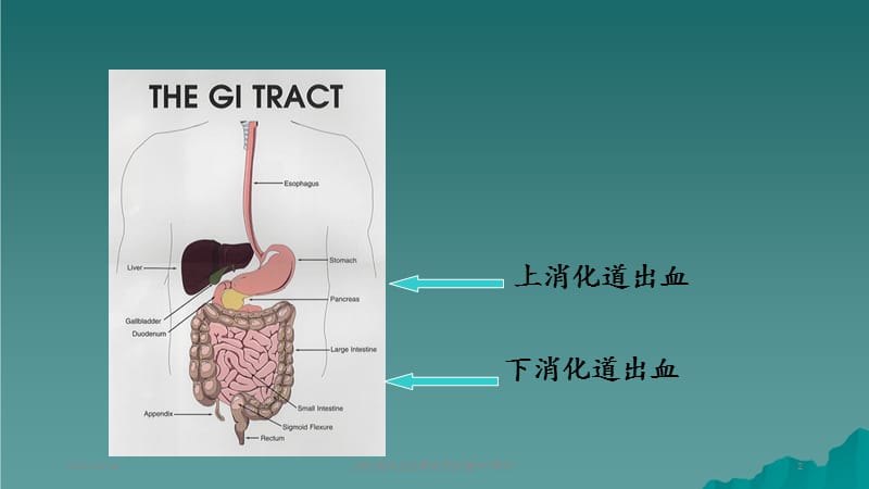 消化道出血的急救与护理 (2).ppt_第2页