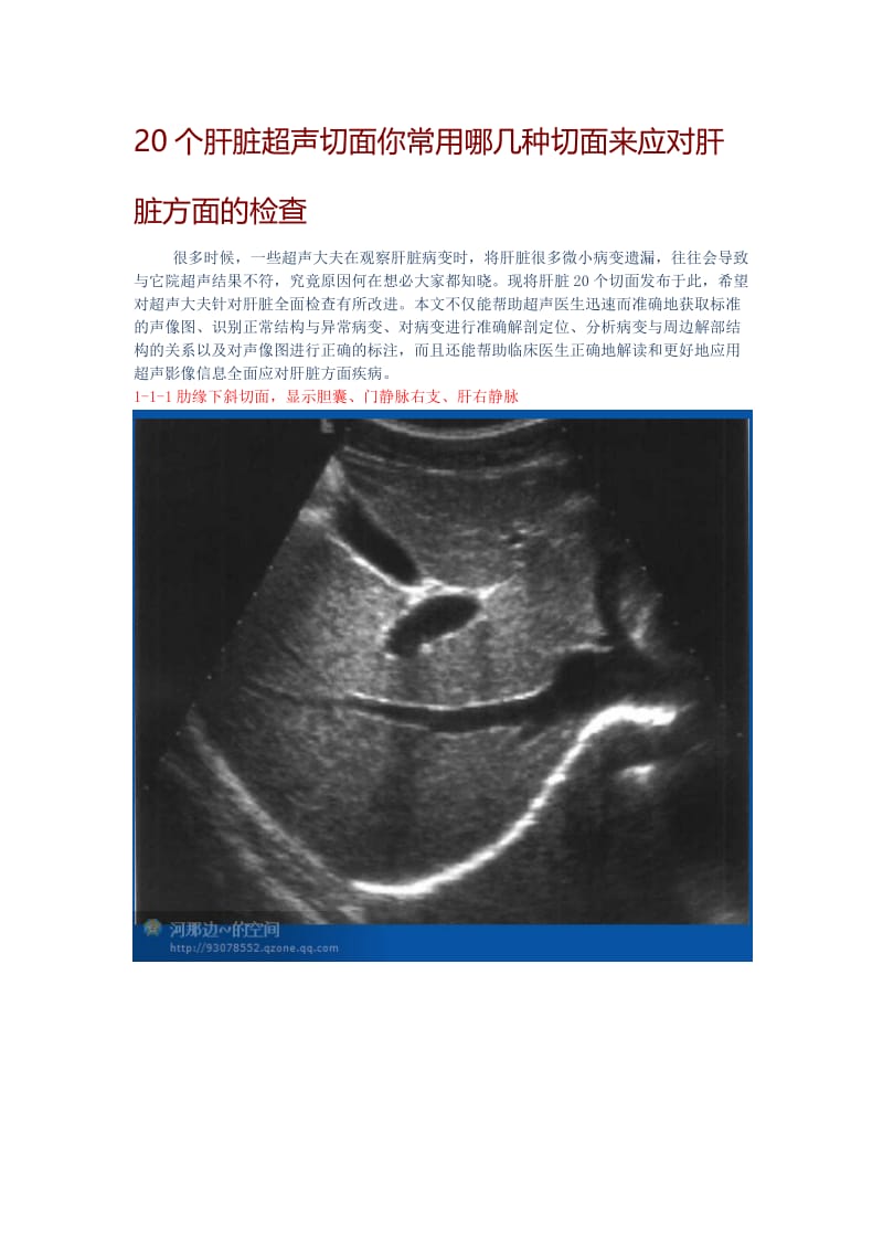 20个肝脏超声切面你常用哪几种切面来应对肝脏方面的检查.doc_第1页