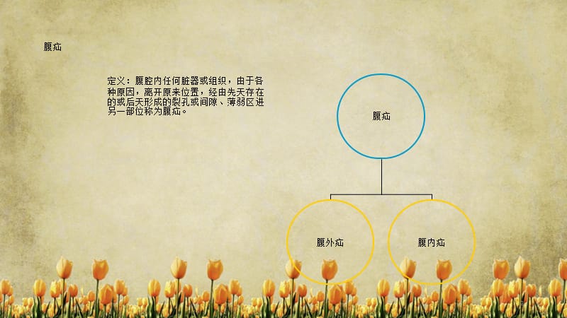 腹外疝影像学诊断（精选).ppt_第3页