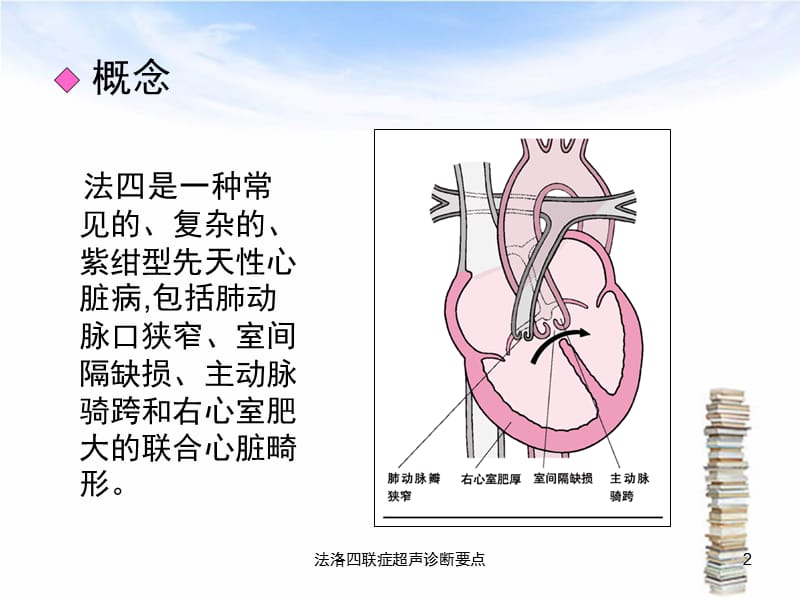 法洛四联症超声诊断要点课件.ppt_第2页