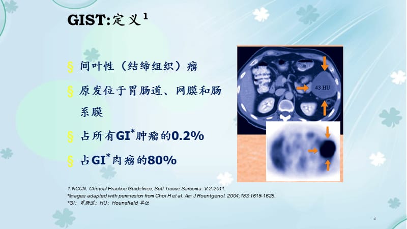 胃肠道间质瘤综合治疗经验分享（）.ppt_第3页