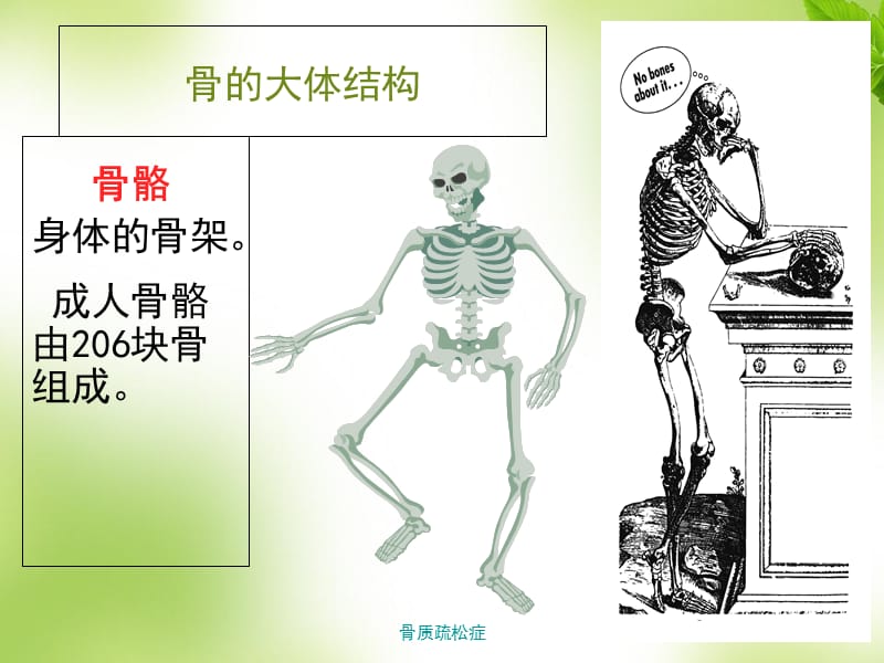 骨质疏松症课件.ppt_第2页