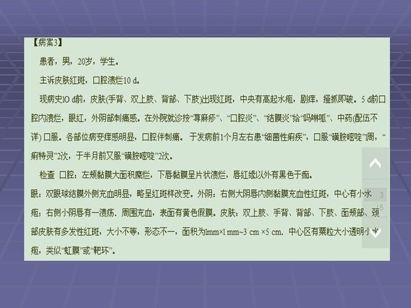 口腔粘膜病病例分析.ppt_第3页