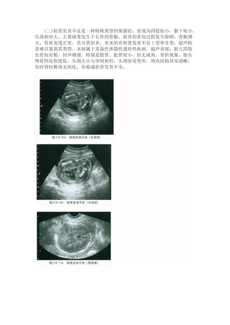 常见胎儿骨发育不良的超声表现.doc_第3页