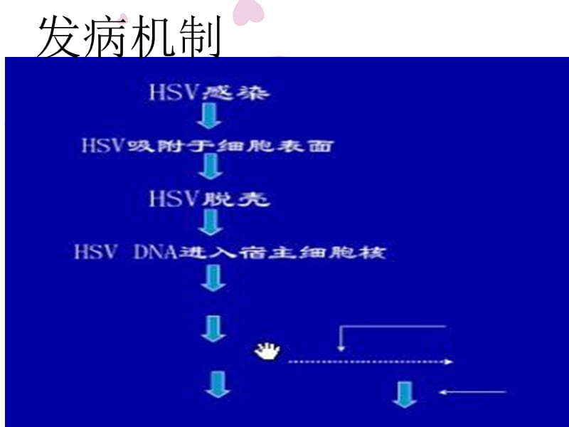 疱疹性口炎,-文档资料.ppt_第3页