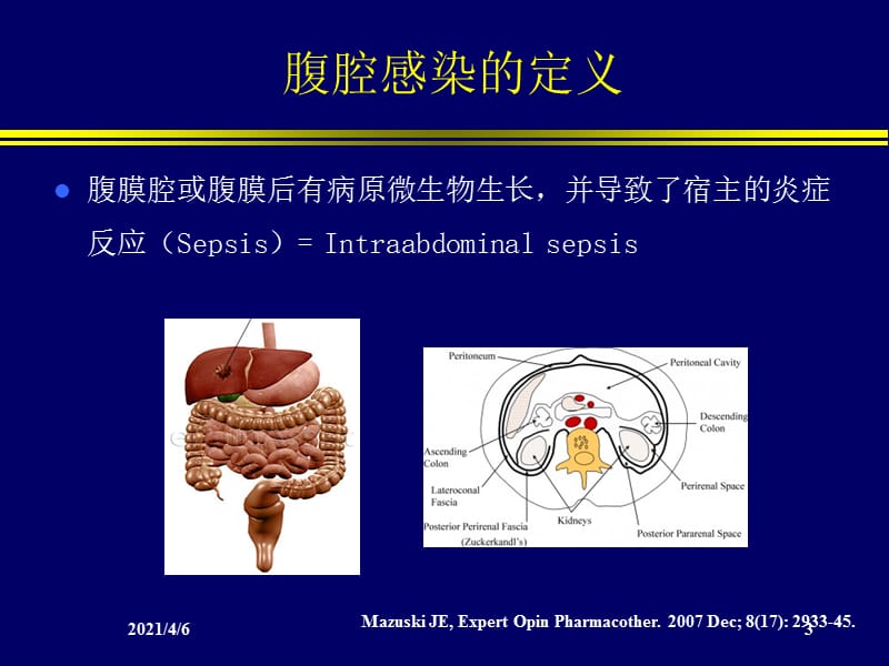 腹腔感染的治疗-文档资料.ppt_第3页