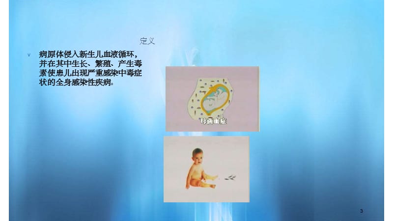 新生儿败血症PPT课件(干货分享).ppt_第3页