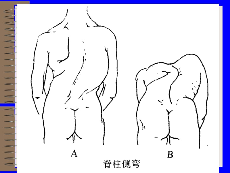 脊柱脊髓损伤的体格检查-文档资料.ppt_第3页