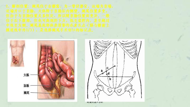 阑尾炎超声诊断课件.ppt_第3页