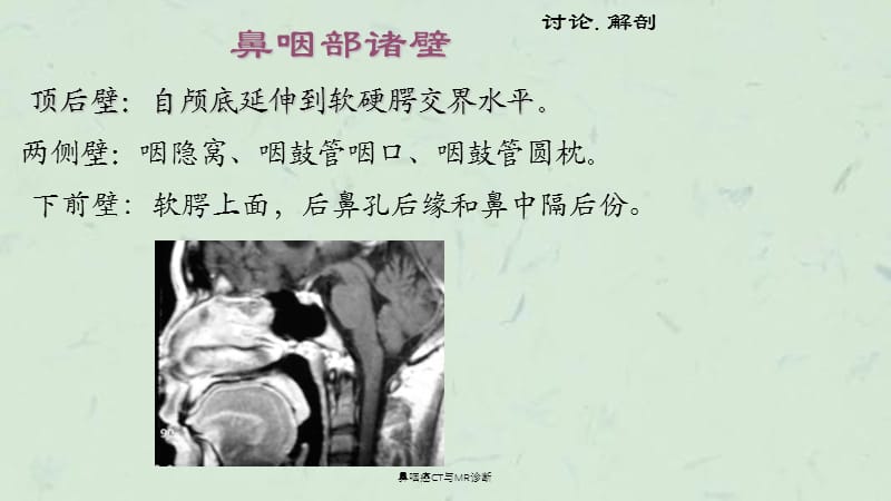 鼻咽癌CT与MR诊断课件.ppt_第3页