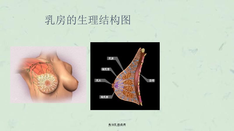 良性乳腺疾病课件.ppt_第3页