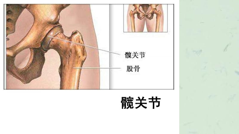 髋关节精美图课件.ppt_第3页