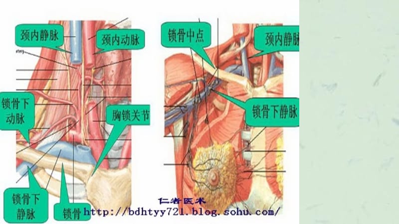 锁骨下静脉穿刺图课件.ppt_第3页