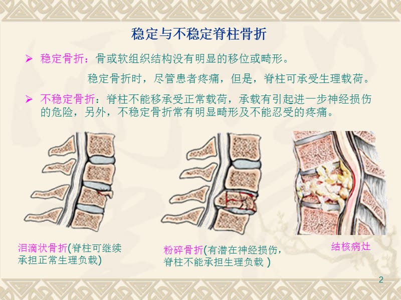 四节人体脊柱临床不稳定问题(课堂PPT).ppt_第2页