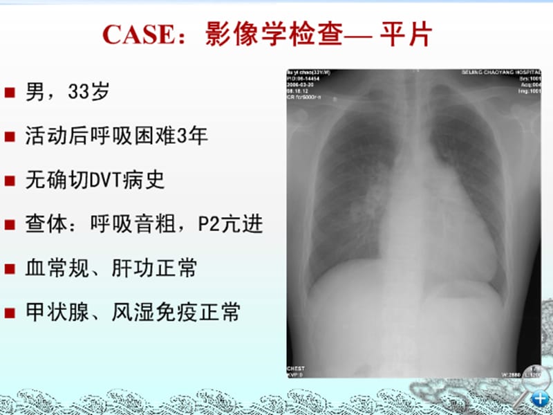 肺动脉高压的诊断与临床分类.ppt_第2页