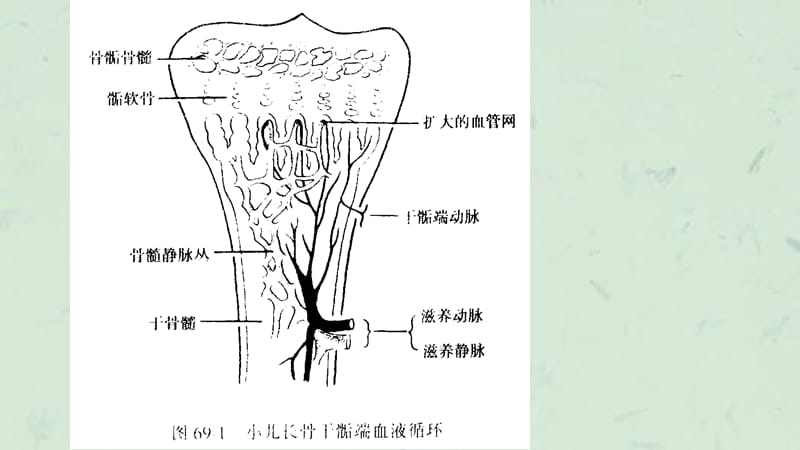 骨髓炎和结核课件.ppt_第1页