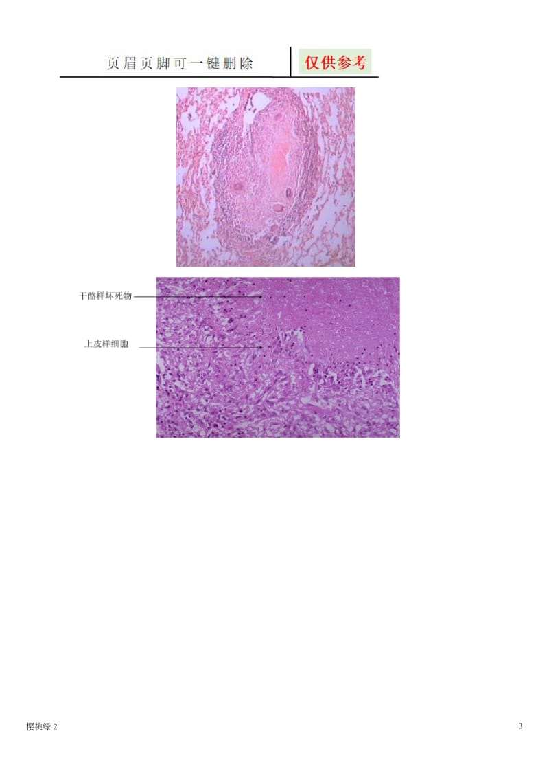 病理学切片和标本[相关知识].doc_第3页