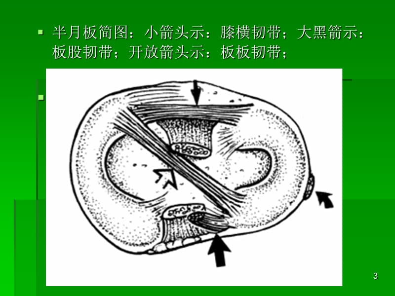 膝关节MRI解剖及损伤课件.ppt_第3页