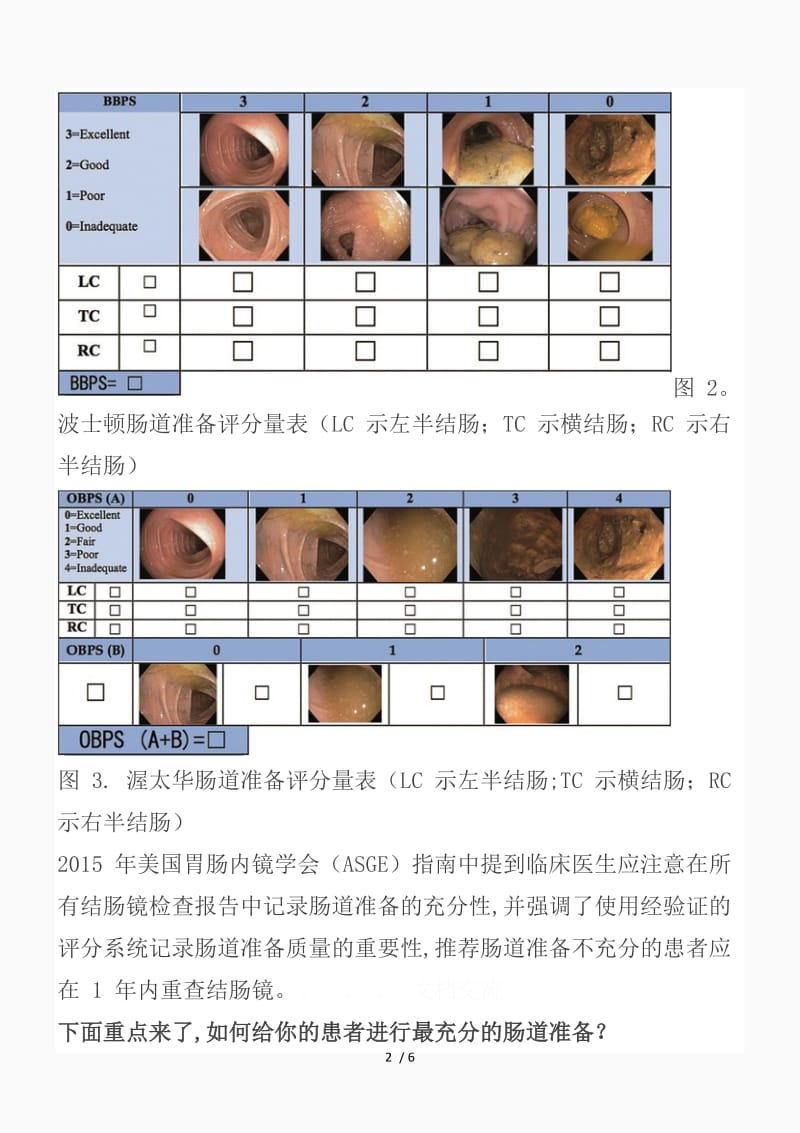 结肠镜检查肠道评估方法（精品课件）.docx_第2页