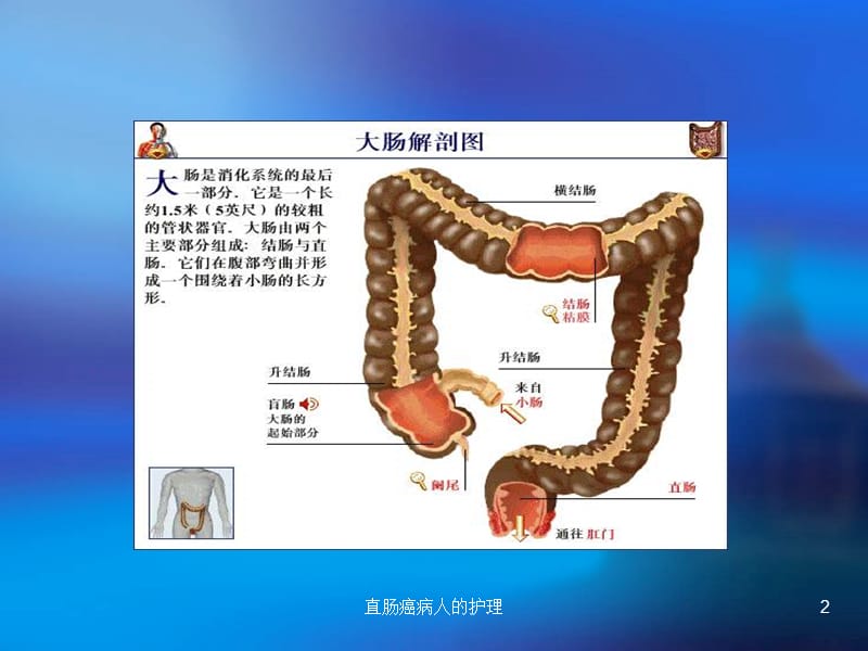 直肠癌病人的护理课件.ppt_第2页