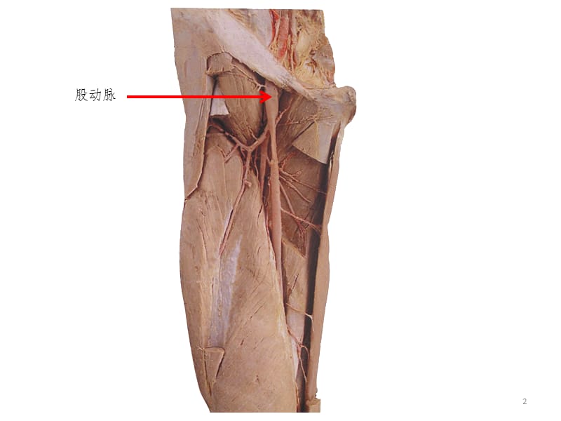 脉管-感觉器标本训练题PPT课件.ppt_第2页