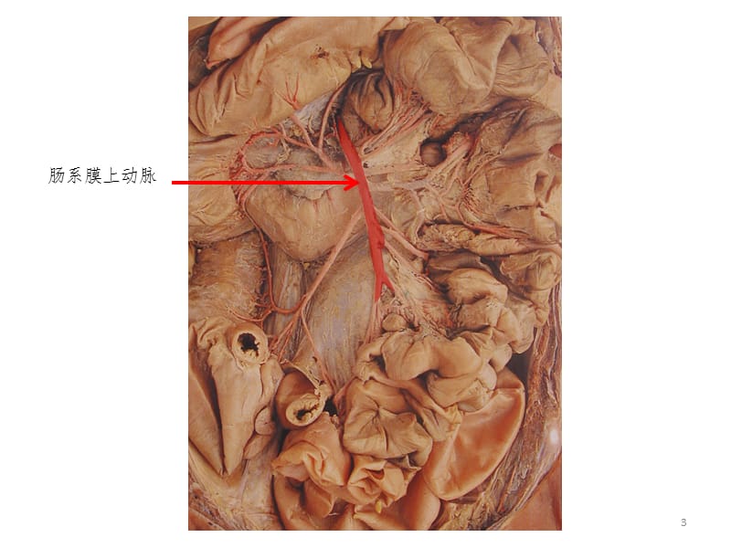 脉管-感觉器标本训练题PPT课件.ppt_第3页