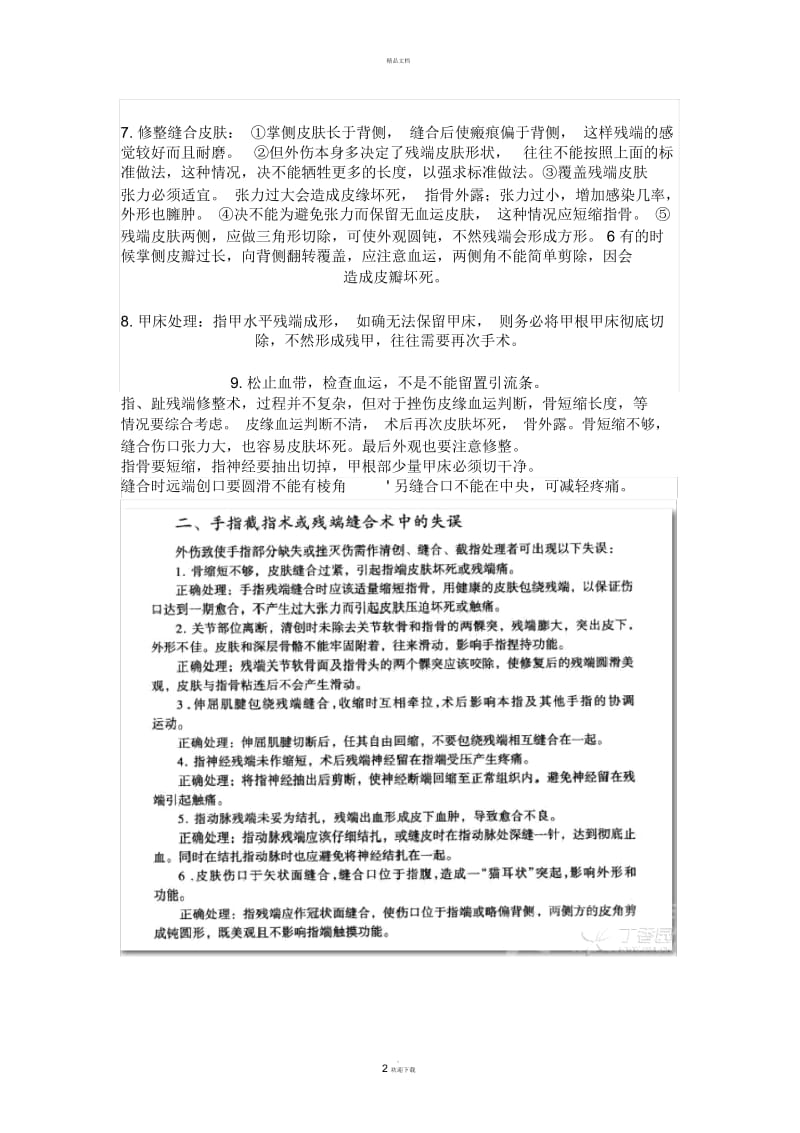 手指残端成形术.docx_第2页