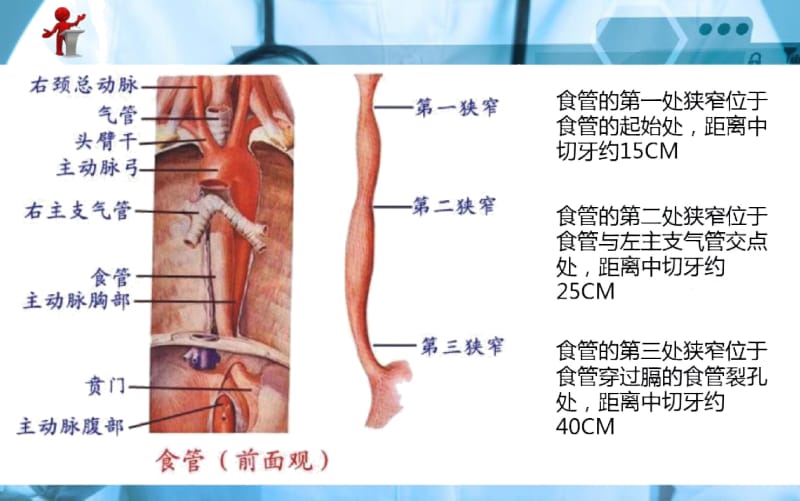 【优质文档】外科护理食管癌病人的护理.docx_第2页