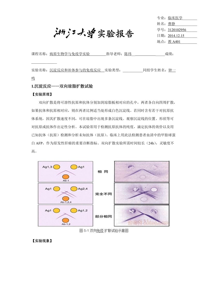 免疫学——沉淀反应.docx_第1页