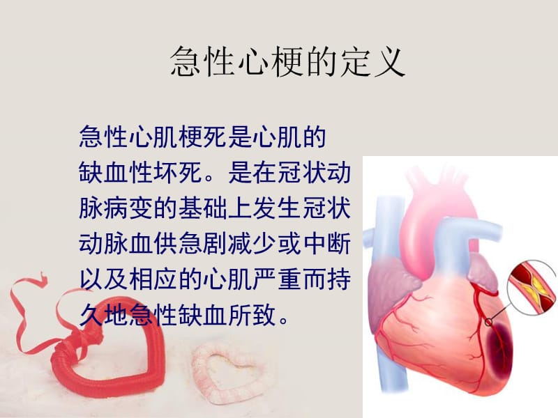 急性心梗的护理.ppt_第3页